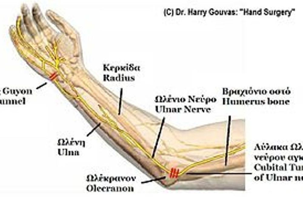 Болят кости после операции. Локтевой сустав анатомия локтевой нерв. Анатомия локтевого нерва в области локтевого сустава. Локтевой нерв в канале Гийона. Строение нервов локтевого сустава.