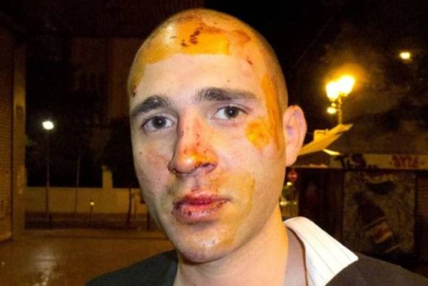 Μπογδάνος: Φωτογραφήθηκε αιμόφυρτος