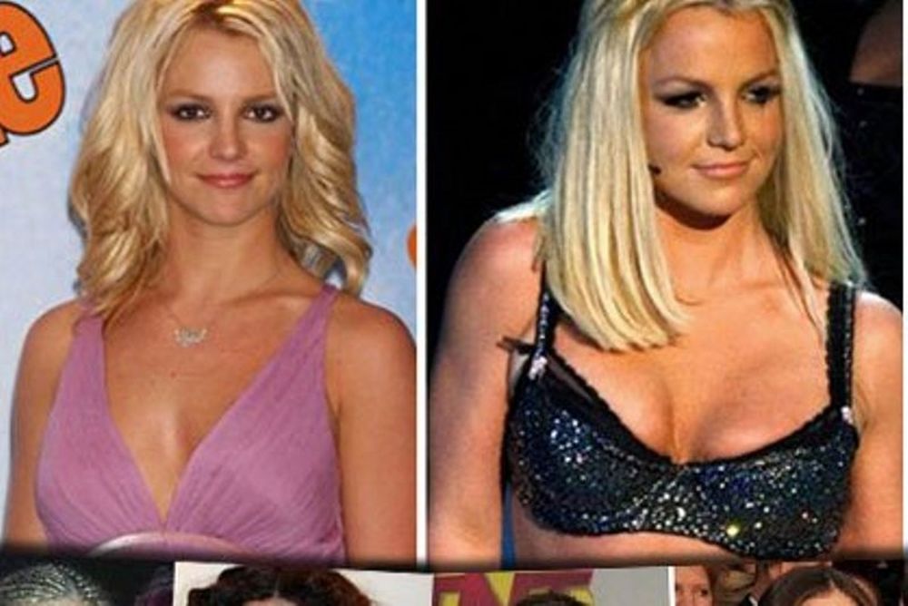 Ποιες διάσημες stars έχουν κάνει πλαστική στήθους; Δείτε photos πριν και μετά τη.. μεγέθυνση!!