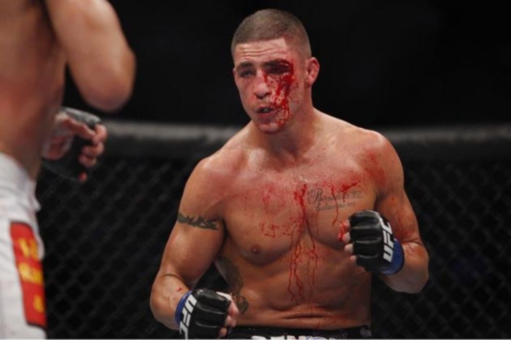 UFC 180: Νέο «πλήγμα», έξω ο Diego Sanchez