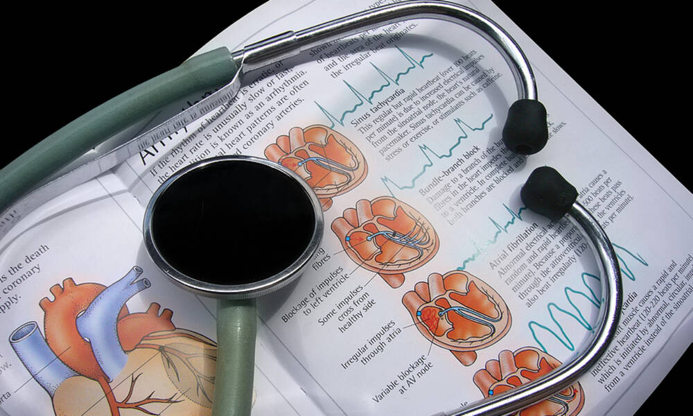 Κολπική μαρμαρυγή: Οι βασικές αιτίες της καρδιακής επιπλοκής (εικόνες)